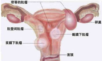 縮陰方法有哪些虹橋醫(yī)院網(wǎng)址