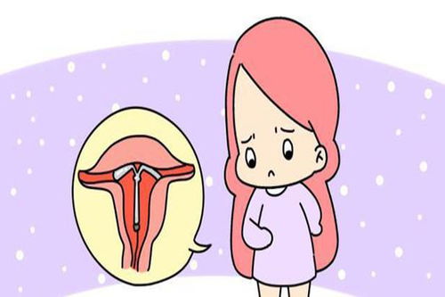 女人裝環(huán)后注意事項(xiàng)