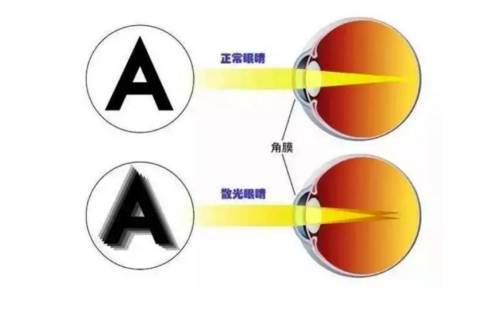 散光,注意事項(xiàng),眼鏡