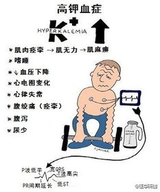 請闡述靜脈補(bǔ)鉀的注意事項