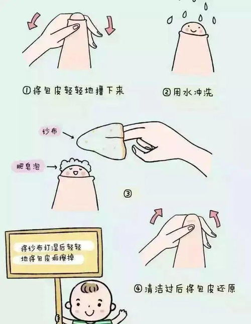 包皮套扎術(shù)注意事項(xiàng)