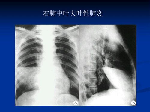 做完核磁后注意事項(xiàng)