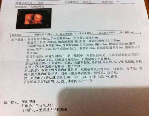 促排懷孕注意事項(xiàng),懷孕初期注意事項(xiàng),貓咪懷孕注意事項(xiàng)