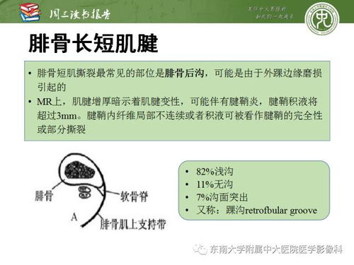 注意事項(xiàng)