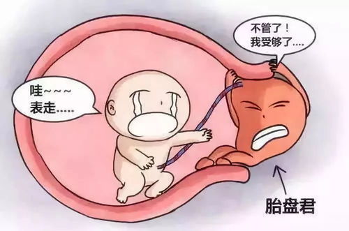 32周胎盤前置注意事項(xiàng)