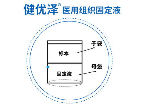 常用固定液的種類及注意事項(xiàng)