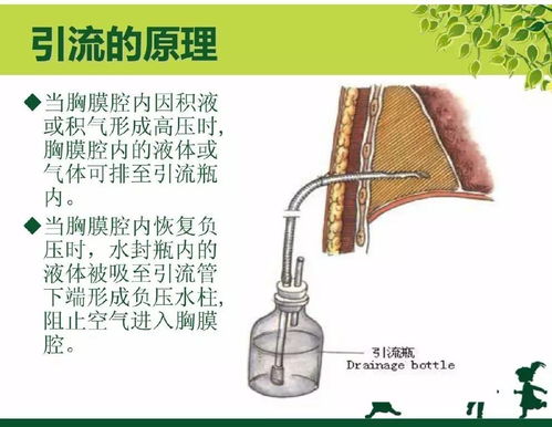 胸膜,引流,注意事項(xiàng),護(hù)理