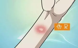 結(jié)合皮試注意事項(xiàng)