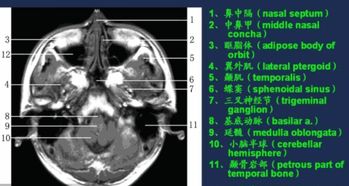 增強(qiáng)核磁共振注意事項(xiàng)