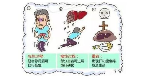 肝損傷恢復(fù)后注意事項(xiàng)