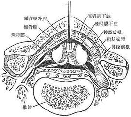 脊椎麻醉后注意事項,脊椎正骨后的注意事項,脊椎復(fù)位后注意事項