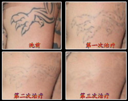 紋身,注意事項