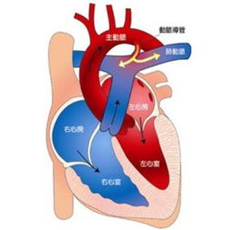 嬰兒肺動脈高壓應注意事項