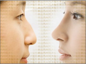 拆線(xiàn),隆鼻,注意事項(xiàng),假體