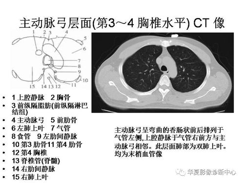 ct讀片基礎(chǔ)知識