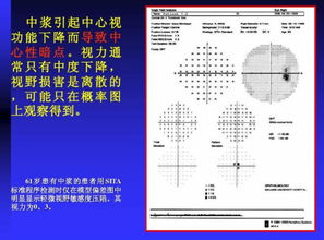 光學(xué)檢測類基礎(chǔ)知識