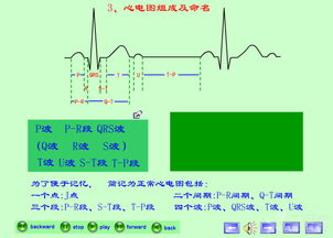 最新章節(jié)心電圖基礎(chǔ)知識1